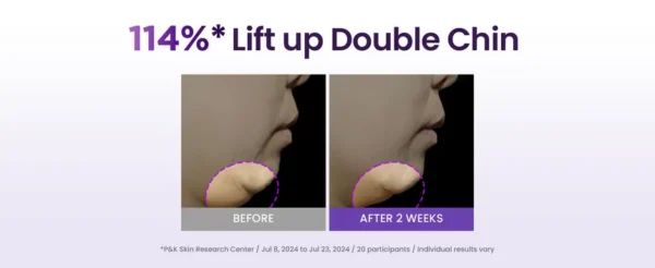 Probioderm 3D Lifting Full Face Tension Gel Mask